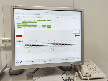 First implementation of ABTC-I on Far Eastern Railway